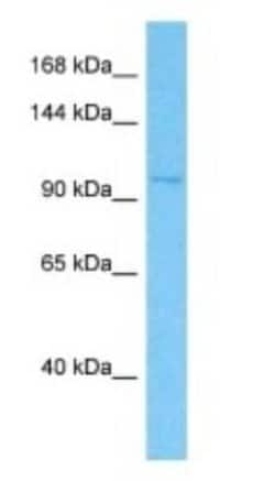 Klotho beta Rabbit anti-Human, Polyclonal, Novus Biologicals 100 &mu;g;